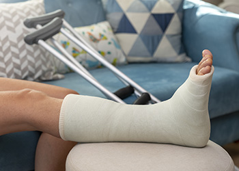 A person with a broken ankle in a plaster cast rests on a couch with crutches in the background