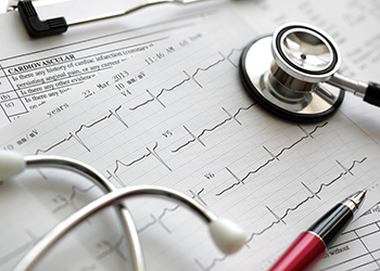 An ECG printout