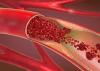 A 3d illustration of a constricted and narrowed artery and the blood cannot flow properly called arteriosclerosis